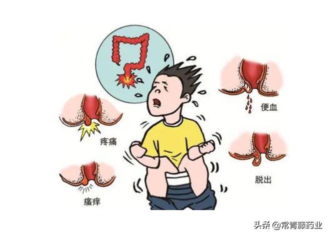 肛门脓肿引流了以后怎么治疗,肛门脓肿破脓后治疗方法