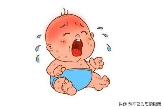 宝宝长湿疹的原因及解决方法,宝宝长湿疹的根本原因是什么