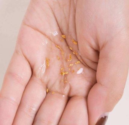 面部松弛怎么打玻尿酸,脸下垂用玻尿酸可以提升吗