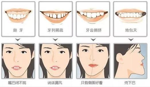 纠结门牙戴牙套还是贴牙片,戴牙套纠结