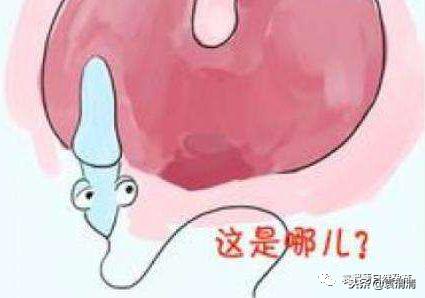 精子死亡怎么治疗调理,精子全部死亡怎么治疗