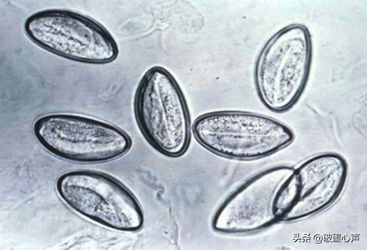 现实中真的存在毒液这种共生体吗,毒液和其他寄生体怎么诞生的