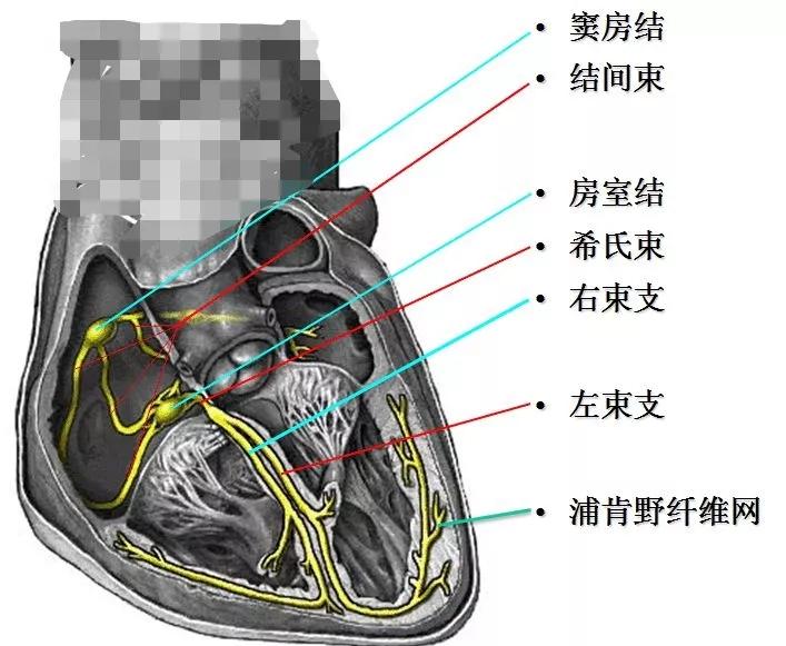 儿童阵发性室上心动过速,儿童阵发性室上性心动过速