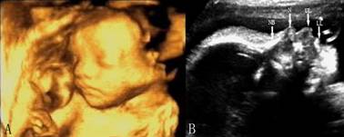 胎儿系统性超声检查有图像么,你需要知道的胎儿超声