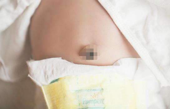 肚脐黑色硬块粘着肉可以清理吗,婴儿肚脐眼黑色的东西能清理掉吗
