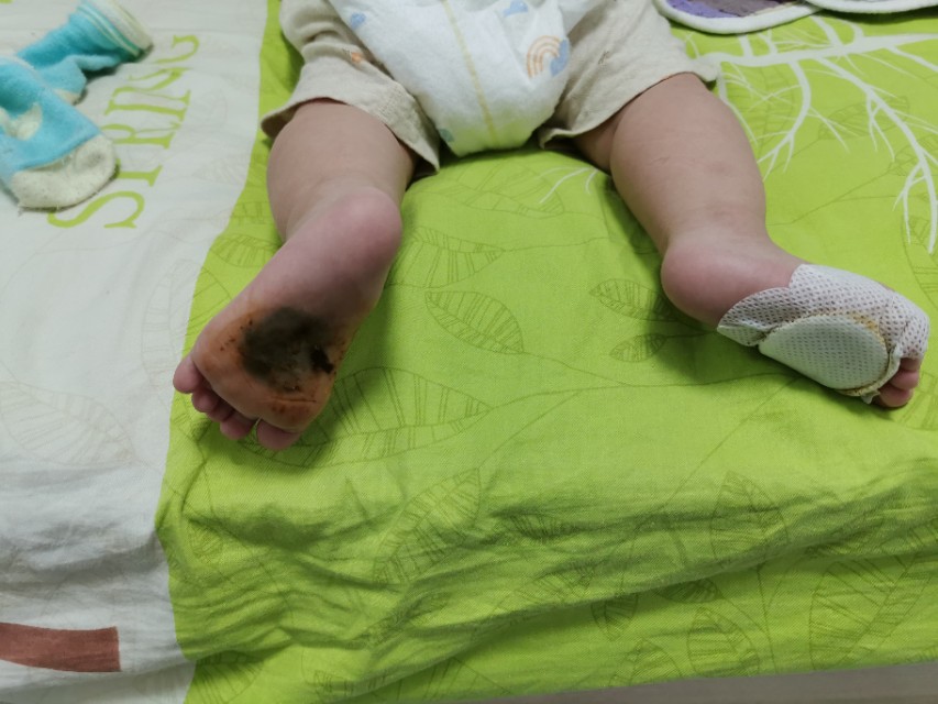 朋友孩子发烧了怎么评论,孩子突然发烧的朋友圈