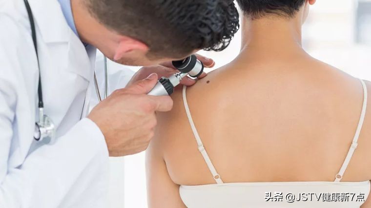 普通的痣会变成黑色素瘤吗,耳朵后黑色素瘤和痣的区别