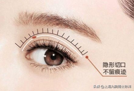 后天自然形成的双眼皮,怎么粘双眼皮贴才自然