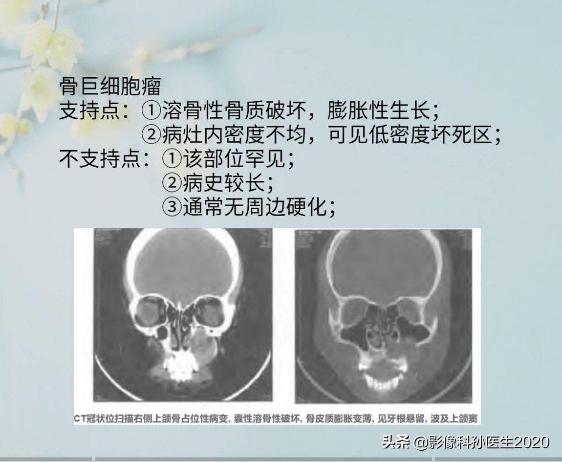 case10什么意思,case案例合集