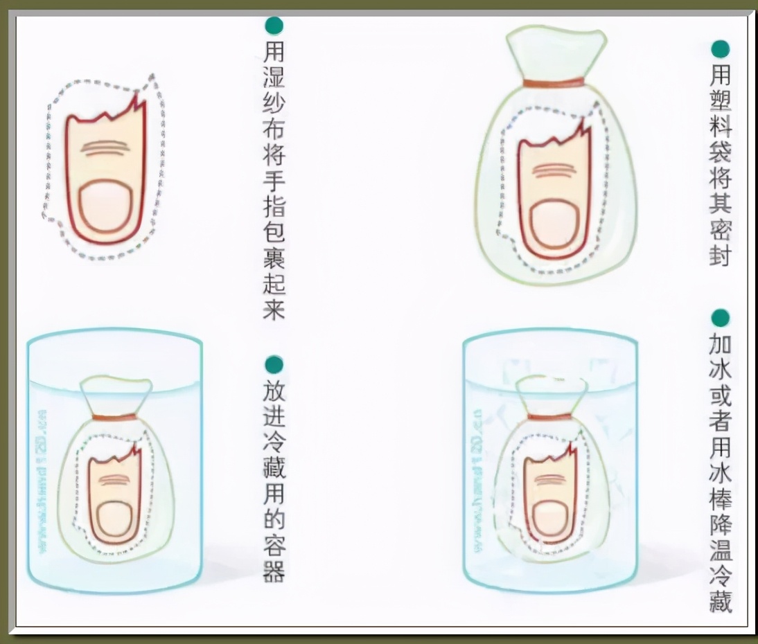 手指没了可以用脚趾代替吗,手指没了可用脚趾接吗
