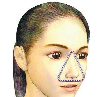 屁股上长痘是什么原因导致,屁股长痘是什么原因造成的