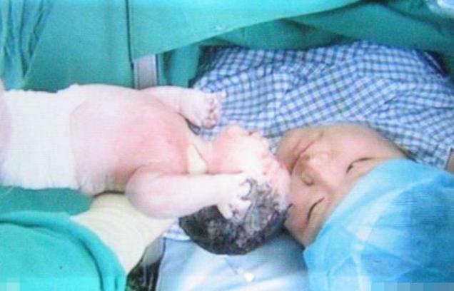 男医生为产妇“刮毛”被拒，随后医生的“解释”，让护士捂嘴偷笑