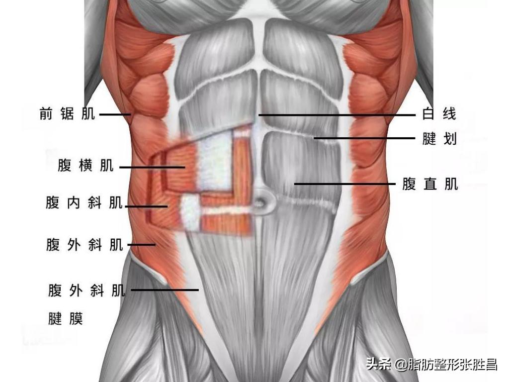 马甲线和腰腹吸脂有什么区别,想要马甲线不想运动