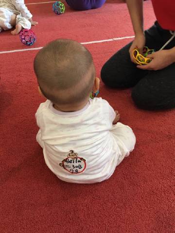 宝宝枕秃怎么治,宝宝缺钙枕秃和正常枕秃区别