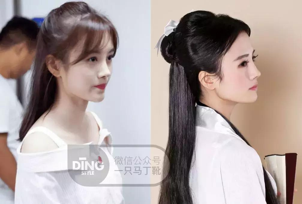 凹面型侧脸怎么改善,凹面型侧脸是怎么造成的