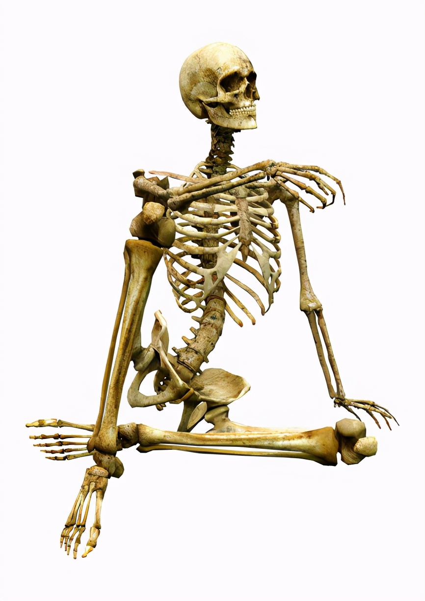 肢端肥大症是骨头变大吗,肢端肥大症真实事例