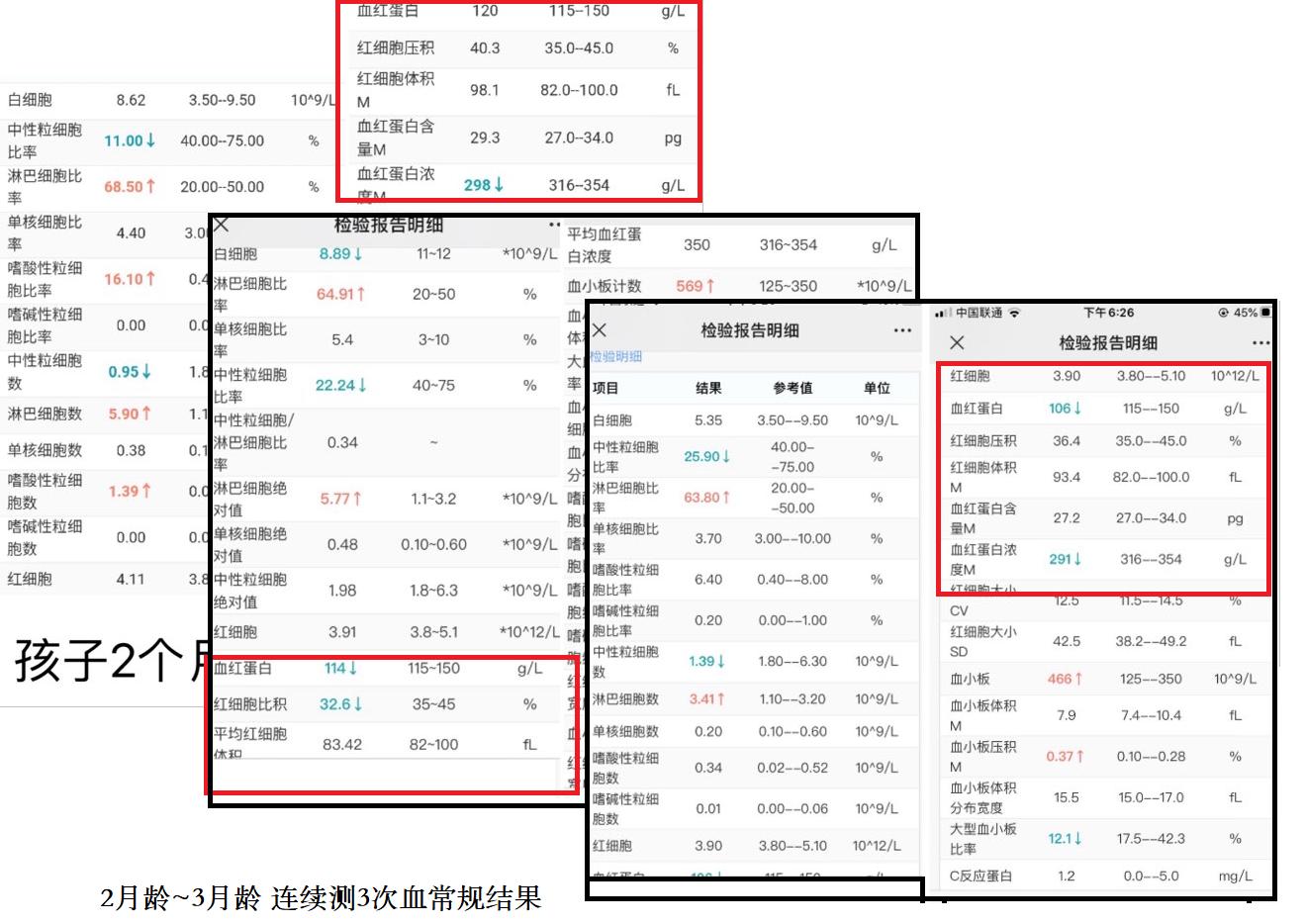 不是所有怀孕贫血了都要补铁,宝宝不是缺铁性贫血是什么原因