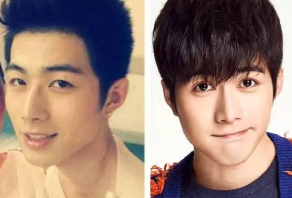 男生小眼睛割双眼皮前后对比,男生割双眼皮多久恢复自然