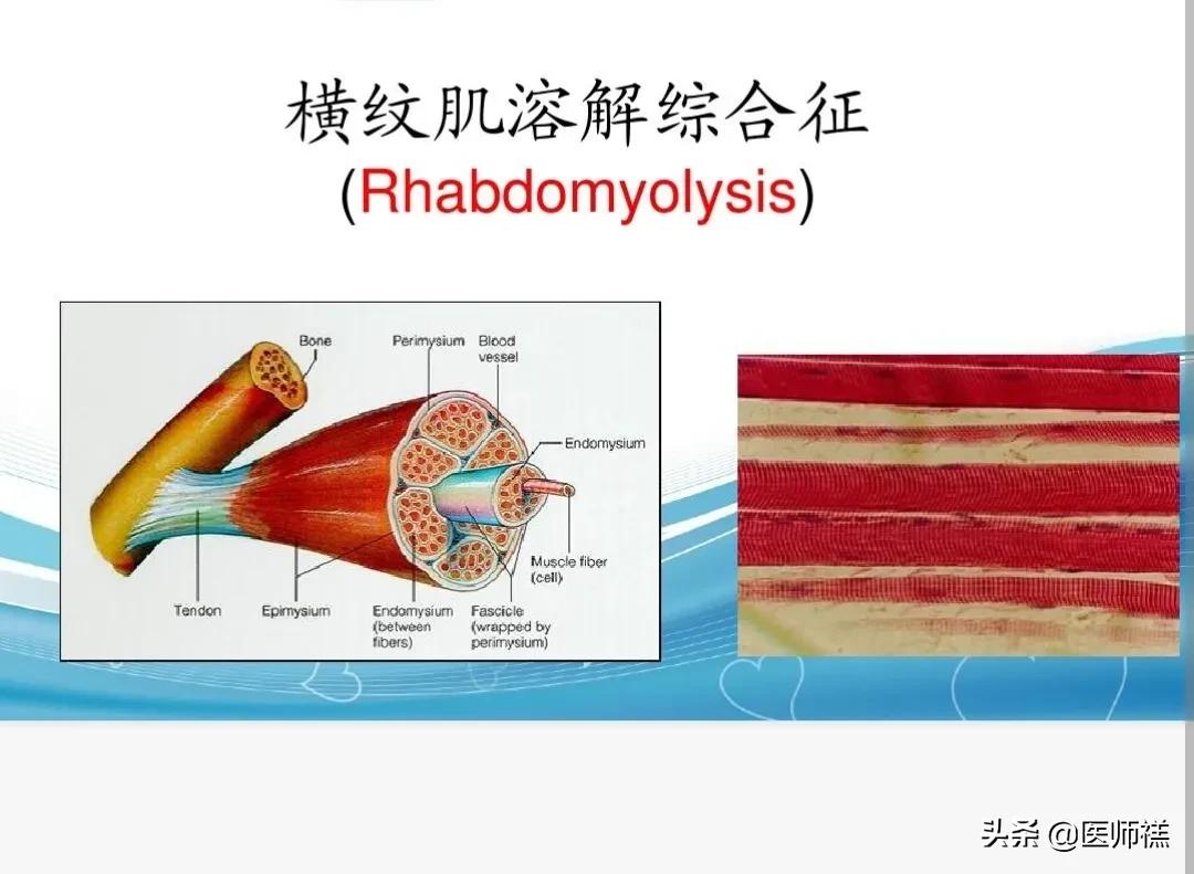 医生提醒阿托伐他汀的常见副作用,长期吃阿托伐他汀需要注意什么