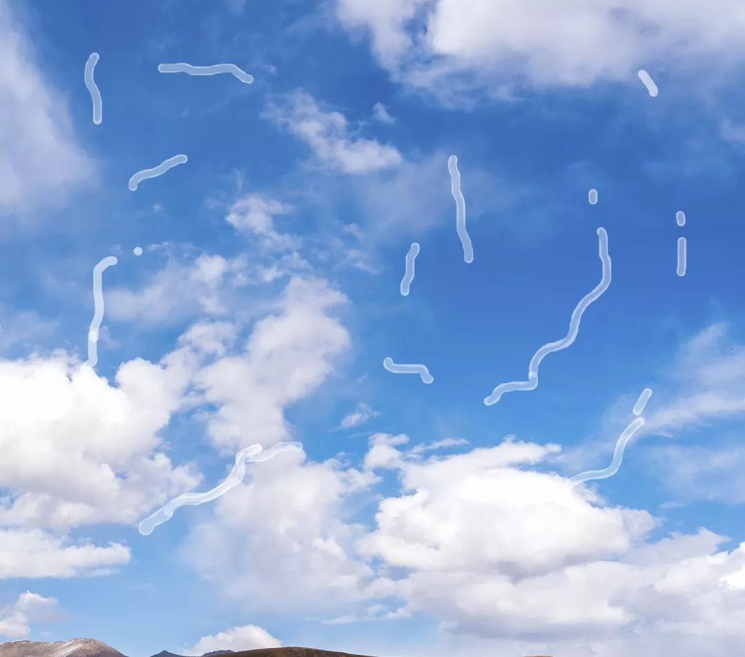 30岁得了飞蚊症,得了飞蚊症会失明吗