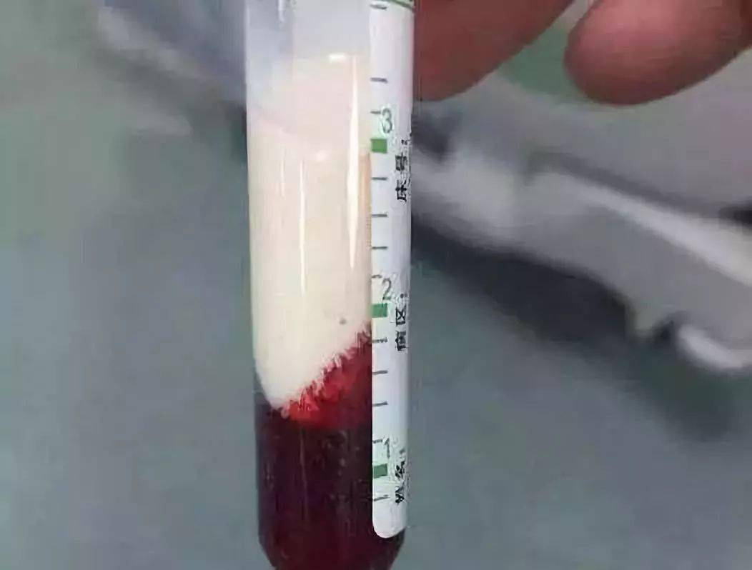 内陆太攀蛇是地球最毒的毒蛇，为什么致死率却是0？