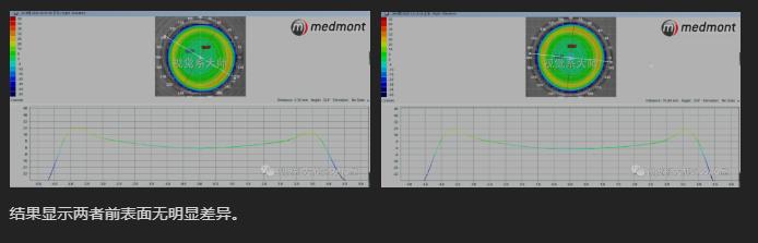 ok镜一周不戴近视更厉害吗,戴了ok镜真的可以恢复视力吗