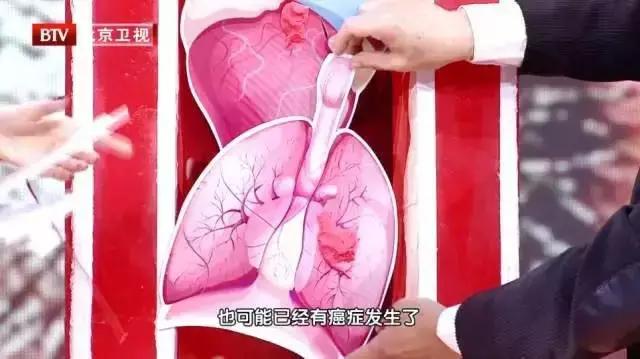 常见恶性肿瘤的警告信号,医生总结了恶性肿瘤的八个信号