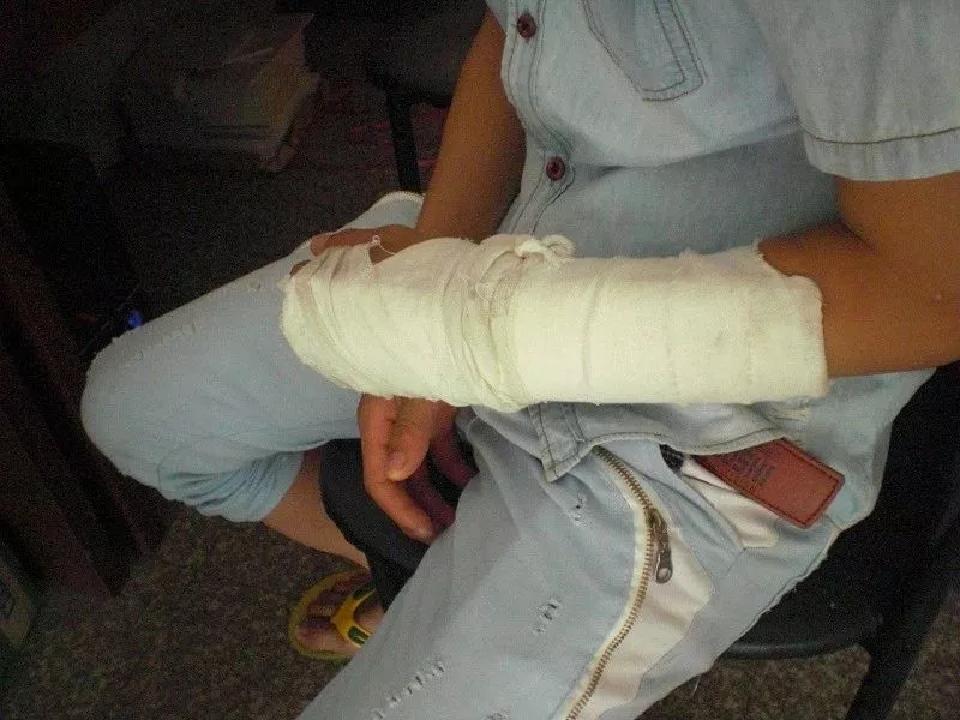 手机充电放枕头下引起火灾,手机在床头充电爆炸