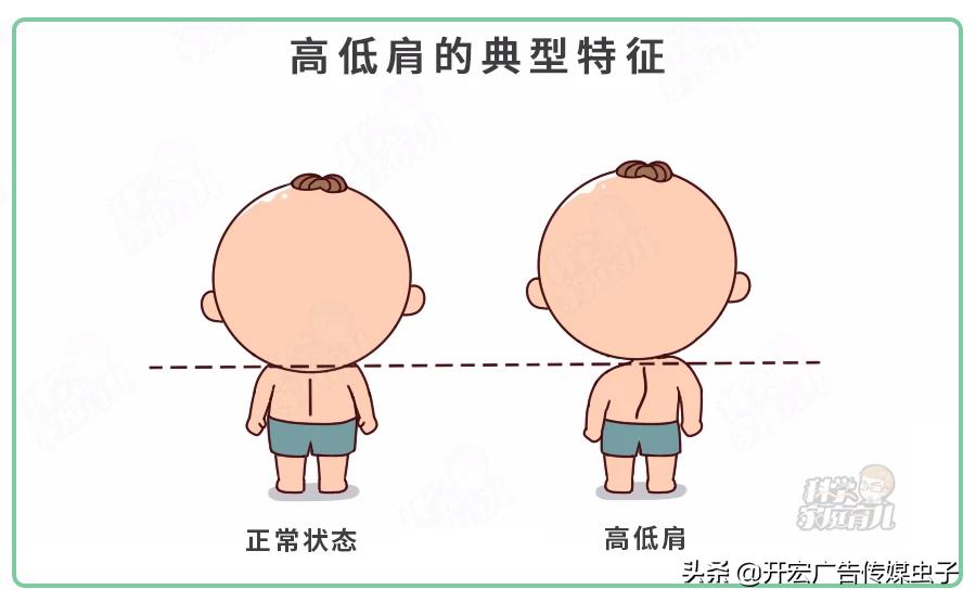 孩子弓腰驼背做运动可以改善吗,4岁坐姿驼背矫正方法