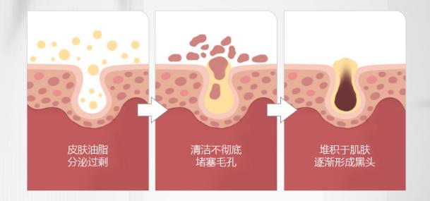 学生党也能轻松get全套护肤品,学生党零基础护肤必买清单