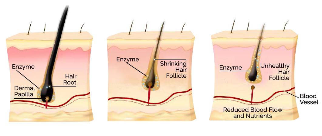 秃头的真相：毛囊干细胞分裂的改变导致，启发了脱发治疗新方法
