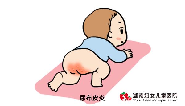 儿童身上皮疹反反复复怎么办,全身皮疹怎样止痒