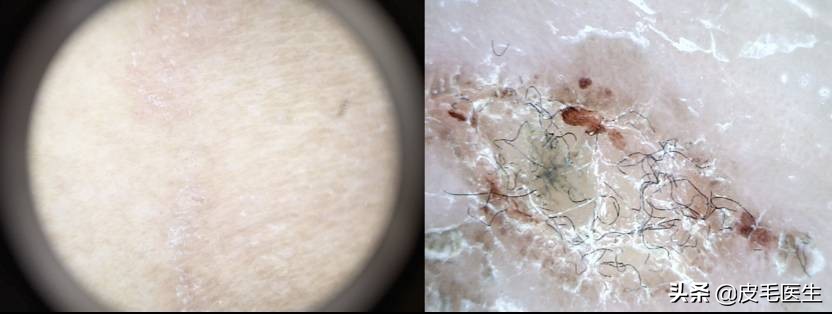 猫狗引起的皮肤瘙痒,猫狗病毒携带及预防