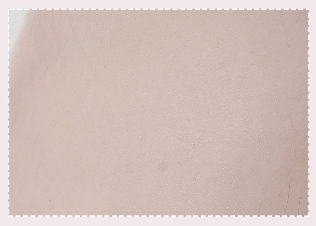 体毛脱毛的效果怎么样,天生体毛旺盛的人正常吗