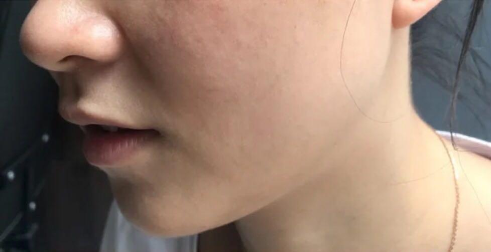 毛孔粗大有黑头适合什么粉底液,遮盖粗大毛孔黑头用什么粉底液