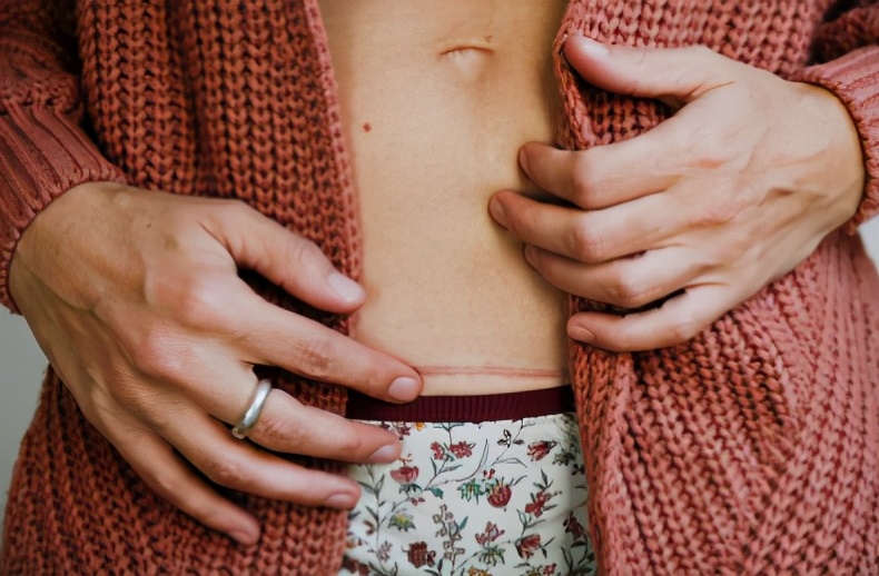 剖腹产妈妈，面临的五大“关卡”，宝爸怎么做才能陪宝妈顺利度过