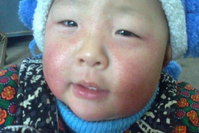 母乳擦脸宝宝皮肤会又白又嫩,母乳擦脸可让宝宝皮肤又白又嫩