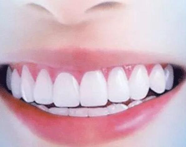 盘点3种口碑不错的牙膏，虽小贵，但真的很好用