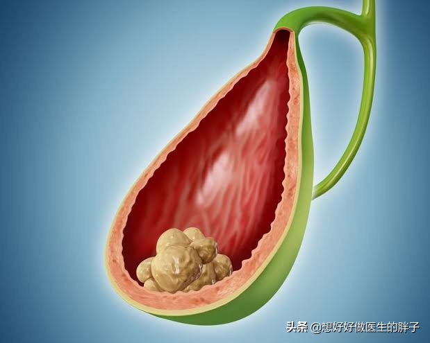 经常觉得右上腹胀,右上腹隐痛有哪些原因和治疗方法