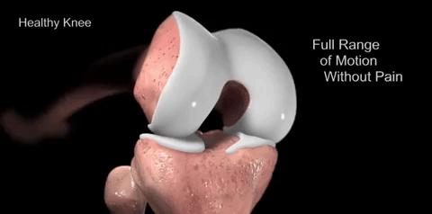 手指骨关节炎如何做康复锻炼,肩骨关节炎的康复锻炼