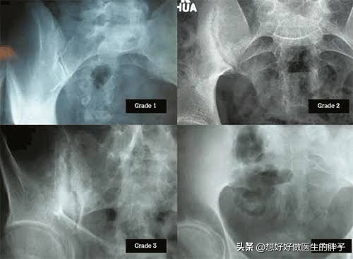 背部内侧疼痛怎么解决男性,年轻男性右侧背部疼痛