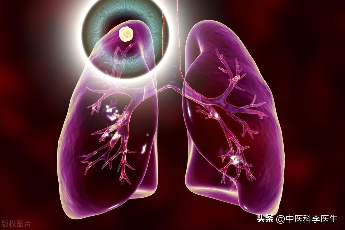 中医治息肉结节囊肿几味中药,为什么会有息肉和囊肿