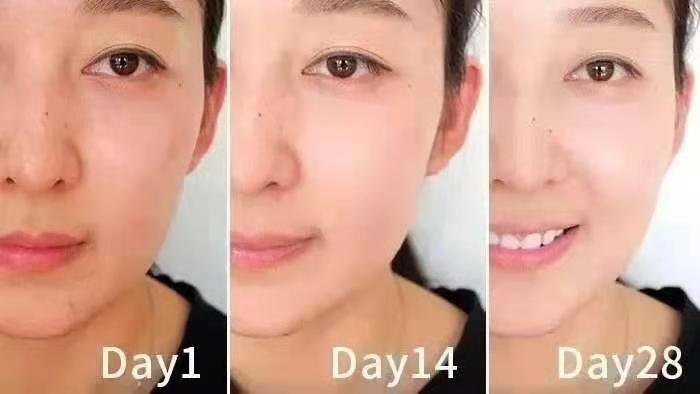 兰蔻极光焕白精华水乳小样,兰蔻极光水乳精华淡斑