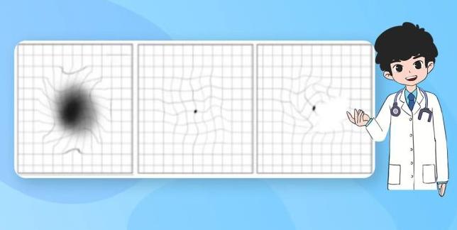 通过查眼睛能判断糖尿病吗,糖尿病眼科疾病的症状