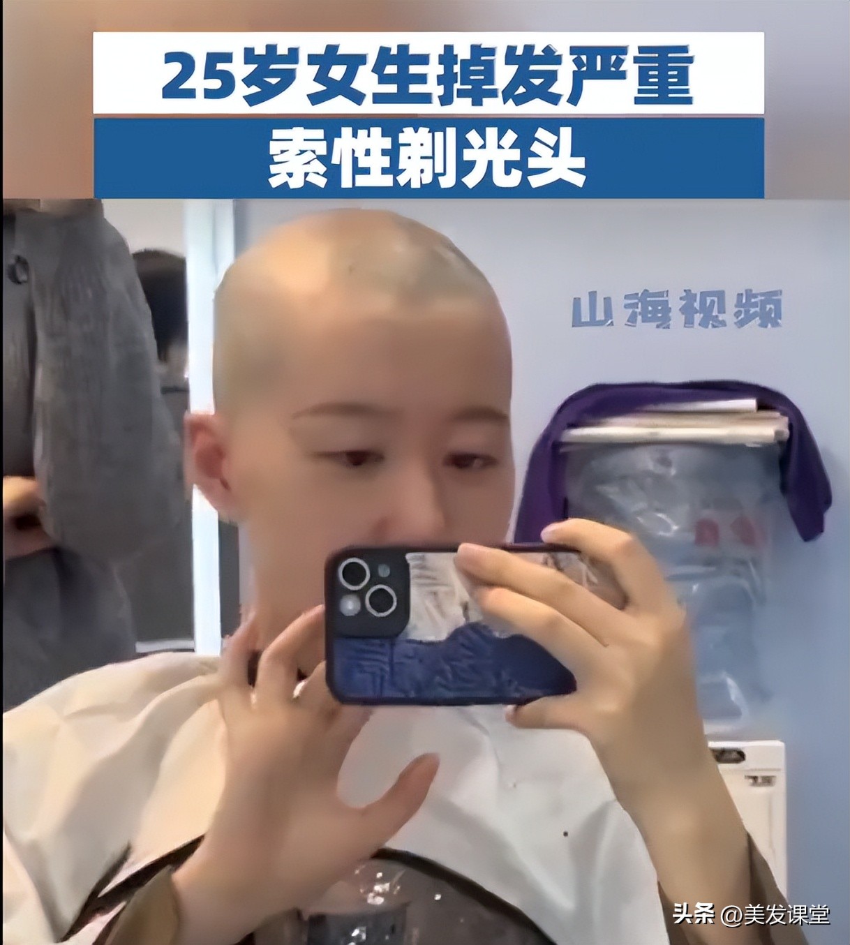 掉发严重剪光头,焦虑想剃光头但是没有勇气怎么办