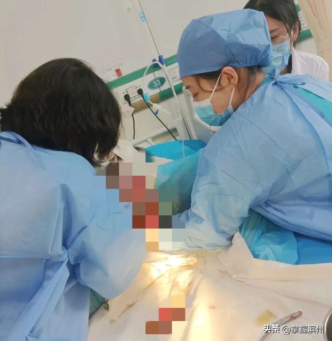 疤痕子宫!臀位分娩!产妇危急!医生妙用助产手法保母婴平安