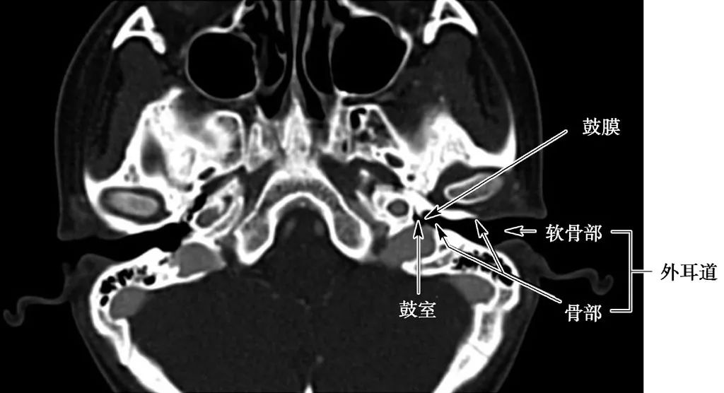 耳部解剖结构和生理功能,耳部解剖笔记
