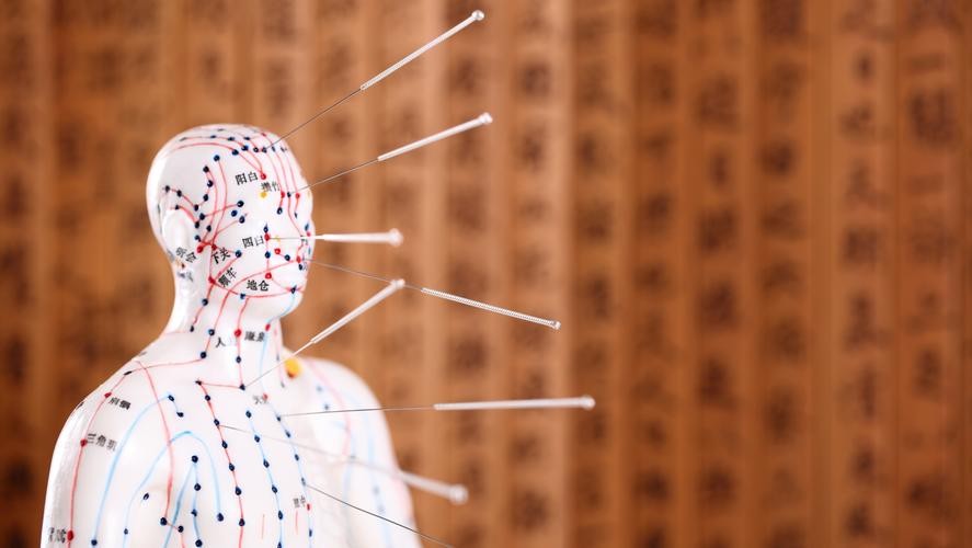 针灸治疗湿疹文献,针灸治疗湿疹视频