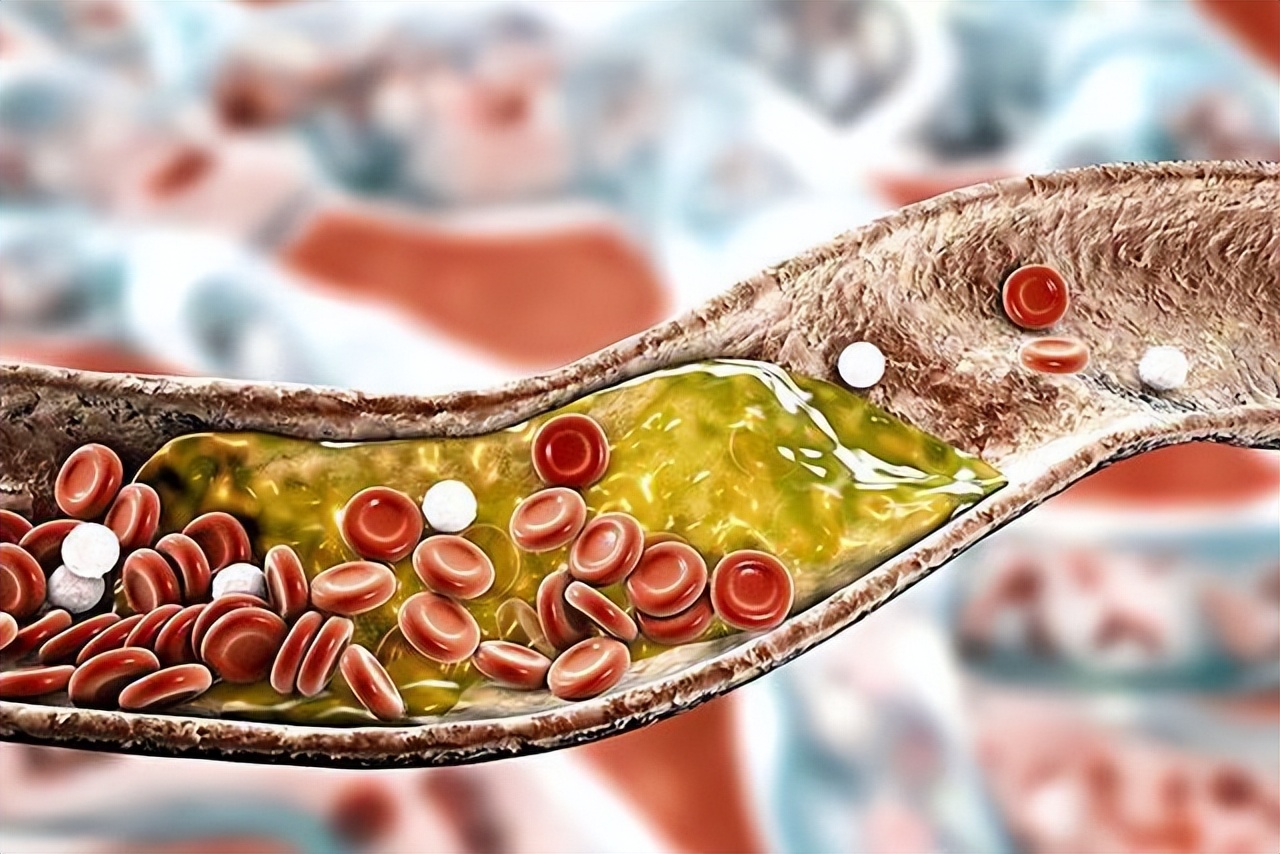 医生建议这4类人尽量少吃玉米,常吃玉米好处多但三类人尽量少碰