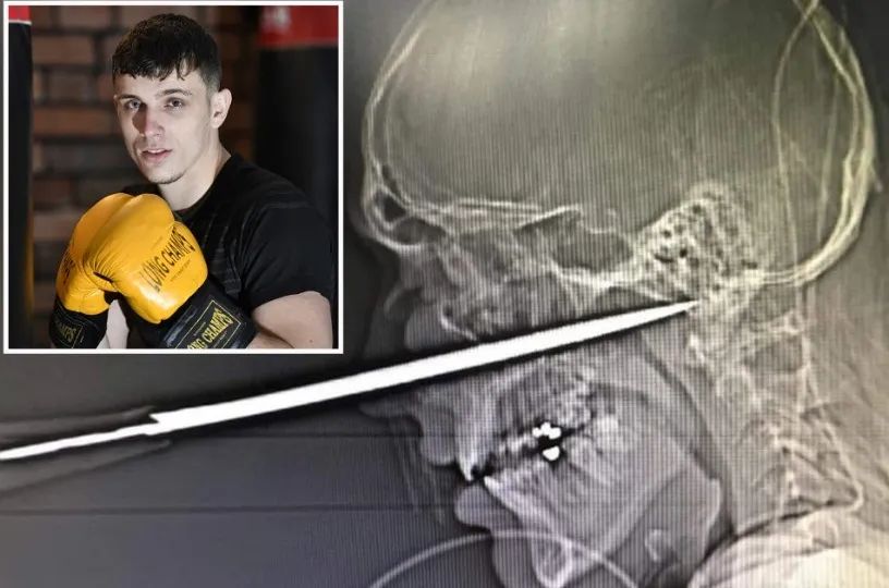 职业拳击手跟普通人打架,职业拳击手被混混打死